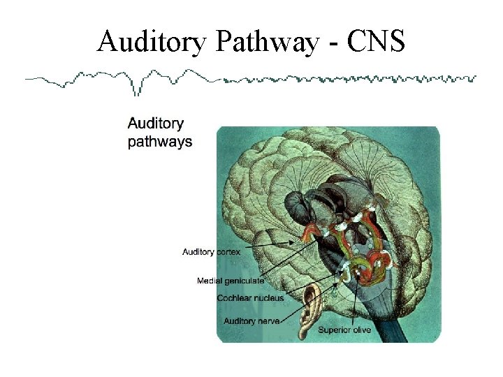 Auditory Pathway - CNS 