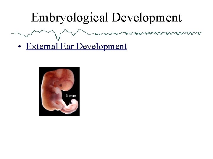 Embryological Development • External Ear Development 