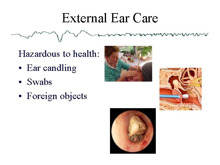 External Ear Care Hazardous to health: • Ear candling • Swabs • Foreign objects