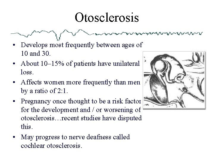 Otosclerosis • Develops most frequently between ages of 10 and 30. • About 10–