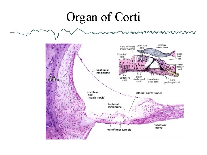 Organ of Corti 