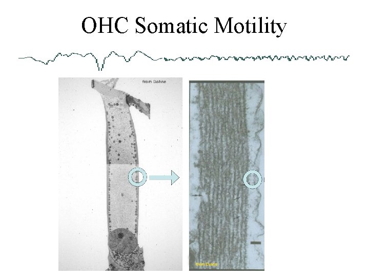 OHC Somatic Motility 