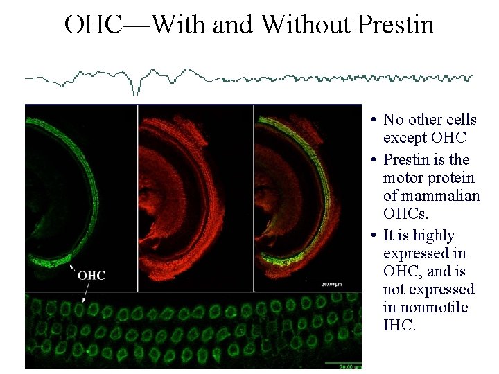 OHC—With and Without Prestin • No other cells except OHC • Prestin is the