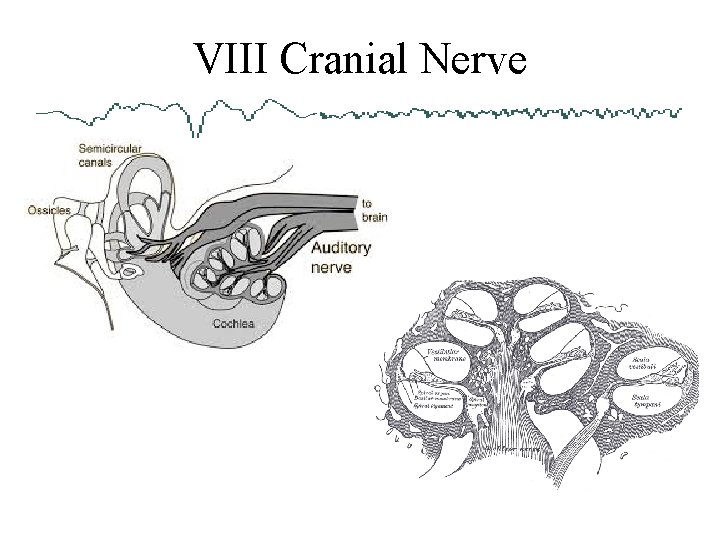 VIII Cranial Nerve 