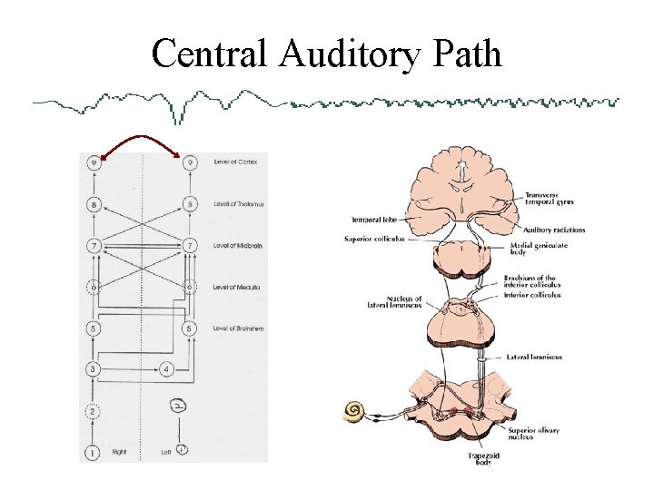 Central Auditory Path 