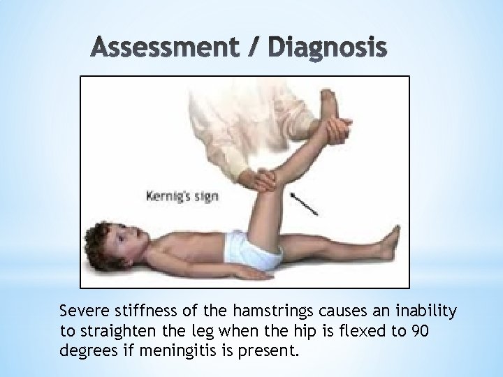 Assessment / Diagnosis Severe stiffness of the hamstrings causes an inability to straighten the