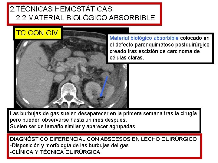 2. TÉCNICAS HEMOSTÁTICAS: 2. 2 MATERIAL BIOLÓGICO ABSORBIBLE TC CON CIV Material biológico absorbible