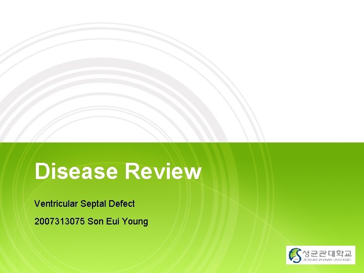 Disease Review Ventricular Septal Defect 2007313075 Son Eui Young YOUR LOGO 