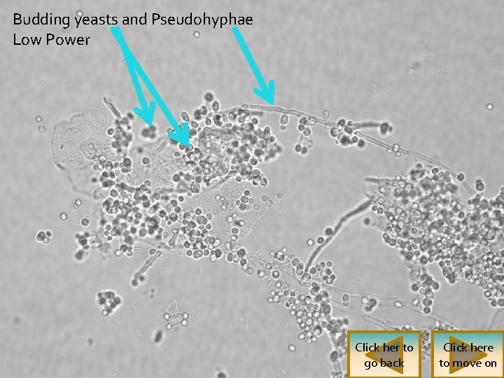 Budding yeasts and Pseudohyphae Low Power Click her to go back Click here to