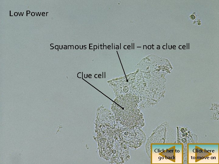 Low Power Squamous Epithelial cell – not a clue cell Click her to go