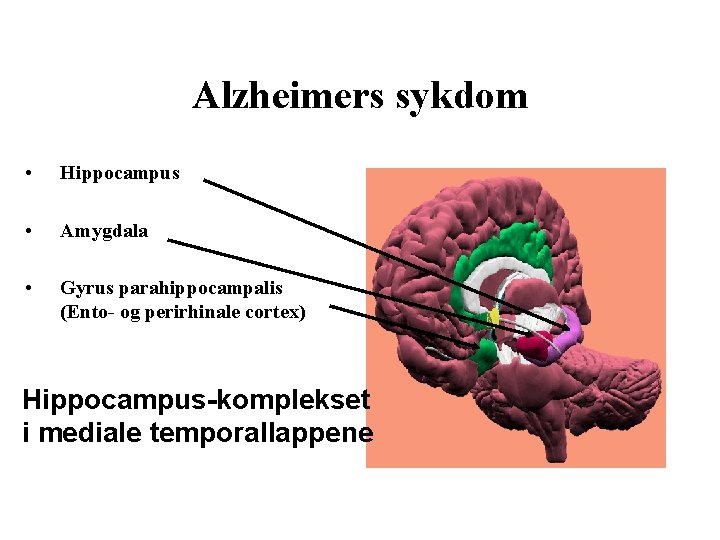 Alzheimers sykdom • Hippocampus • Amygdala • Gyrus parahippocampalis (Ento- og perirhinale cortex) Hippocampus-komplekset