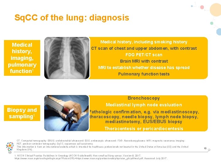 Sq. CC of the lung: diagnosis Medical history, imaging, pulmonary function 1 Biopsy and