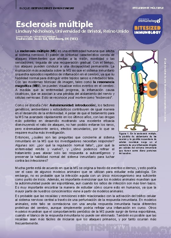 ESCLEROSIS MÚLTIPLE BLOQUE: DISFUNCIONES INMUNITARIAS Esclerosis múltiple Lindsay Nicholson, Universidad de Bristol, Reino Unido