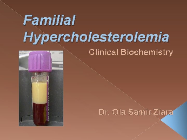 Familial Hypercholesterolemia Clinical Biochemistry Dr. Ola Samir Ziara 