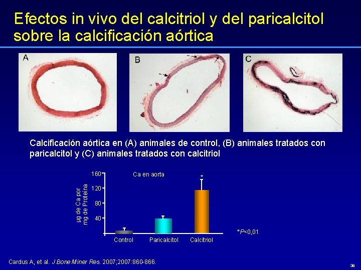 Efectos in vivo del calcitriol y del paricalcitol sobre la calcificación aórtica Calcificación aórtica