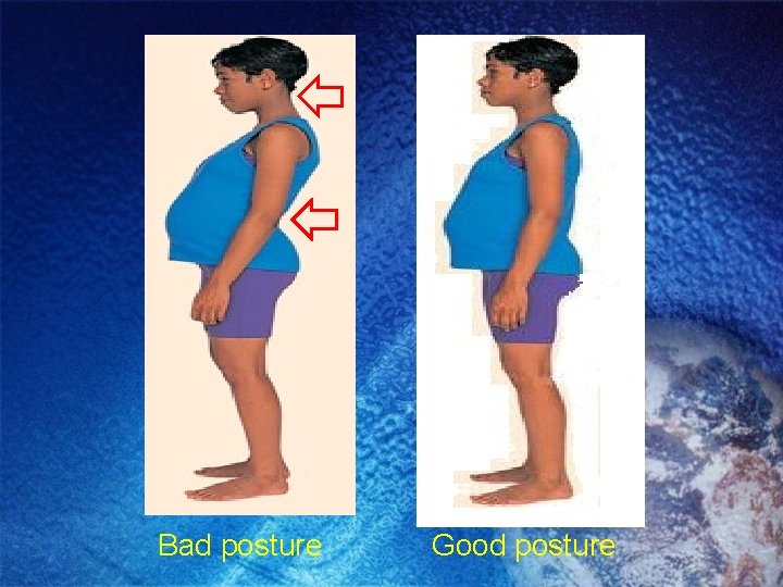 Bad posture Good posture Bad posture Good posture
