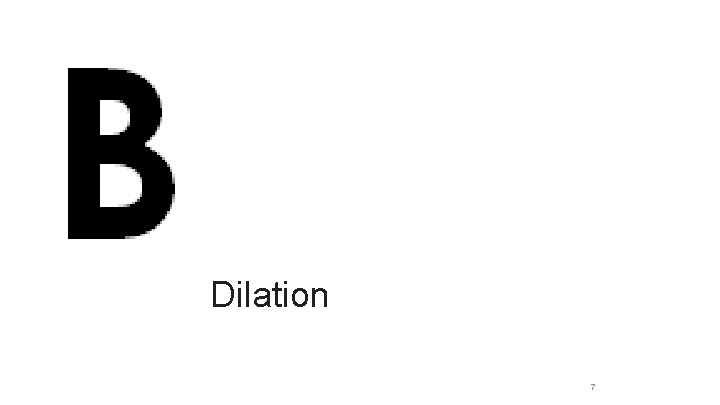 Dilation 7 