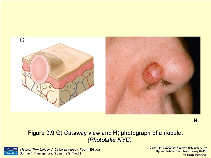 H Figure 3. 9 G) Cutaway view and H) photograph of a nodule. (Phototake