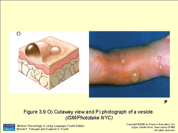 P Figure 3. 9 O) Cutaway view and P) photograph of a vesicle. (ISM/Phototake