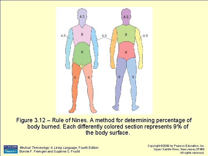 Figure 3. 12 – Rule of Nines. A method for determining percentage of body