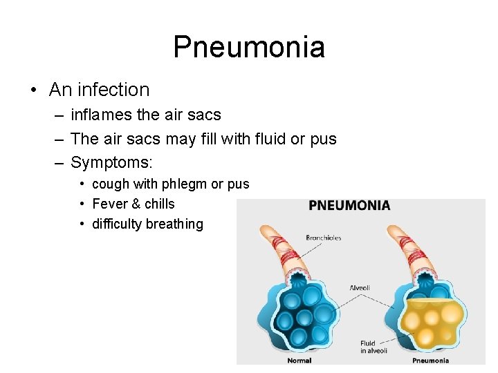 Pneumonia • An infection – inflames the air sacs – The air sacs may