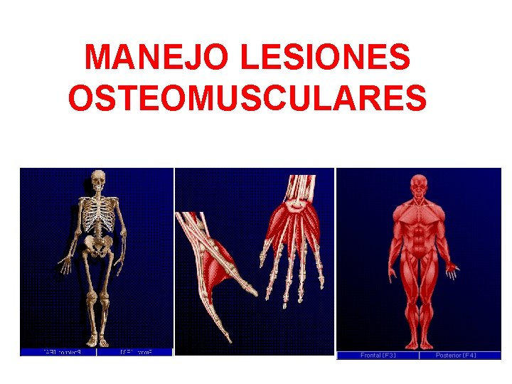 MANEJO LESIONES OSTEOMUSCULARES 
