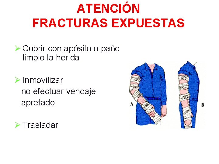 ATENCIÓN FRACTURAS EXPUESTAS Ø Cubrir con apósito o paño limpio la herida Ø Inmovilizar