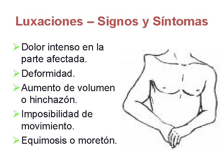 Luxaciones – Signos y Síntomas Ø Dolor intenso en la parte afectada. Ø Deformidad.