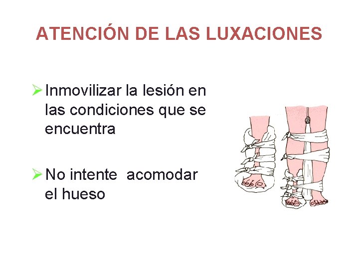 ATENCIÓN DE LAS LUXACIONES Ø Inmovilizar la lesión en las condiciones que se encuentra