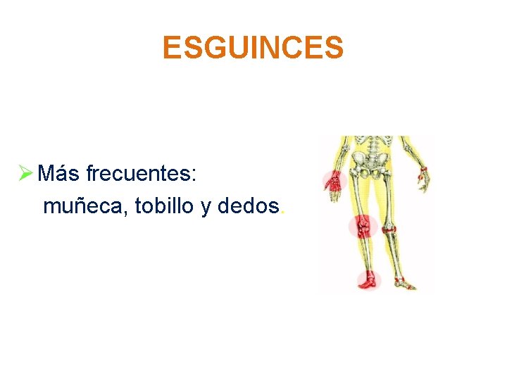 ESGUINCES Ø Más frecuentes: muñeca, tobillo y dedos. 