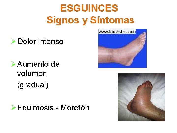 ESGUINCES Signos y Síntomas Ø Dolor intenso Ø Aumento de volumen (gradual) Ø Equimosis