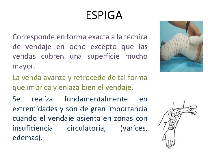 ESPIGA Corresponde en forma exacta a la técnica de vendaje en ocho excepto que