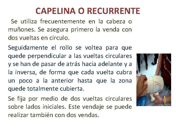 CAPELINA O RECURRENTE Se utiliza frecuentemente en la cabeza o muñones. Se asegura primero