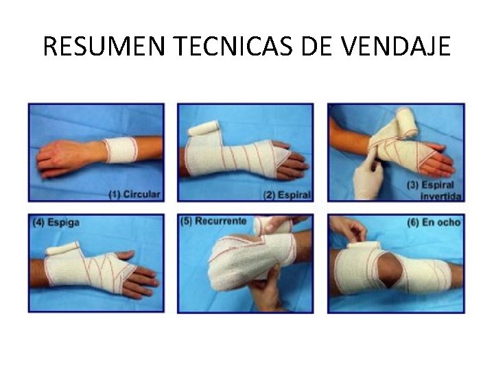 RESUMEN TECNICAS DE VENDAJE 
