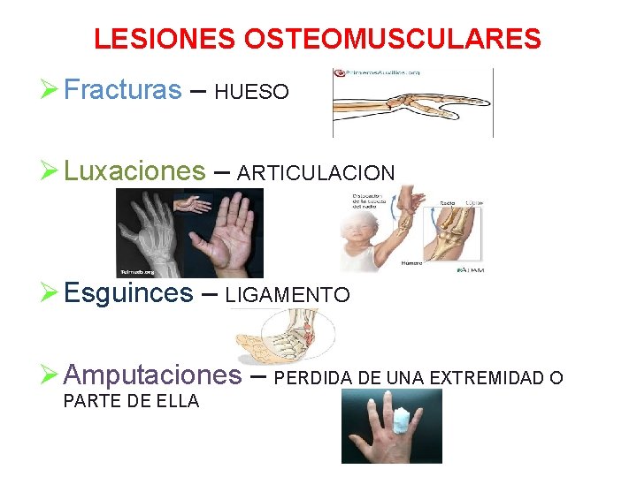 LESIONES OSTEOMUSCULARES Ø Fracturas – HUESO Ø Luxaciones – ARTICULACION Ø Esguinces – LIGAMENTO