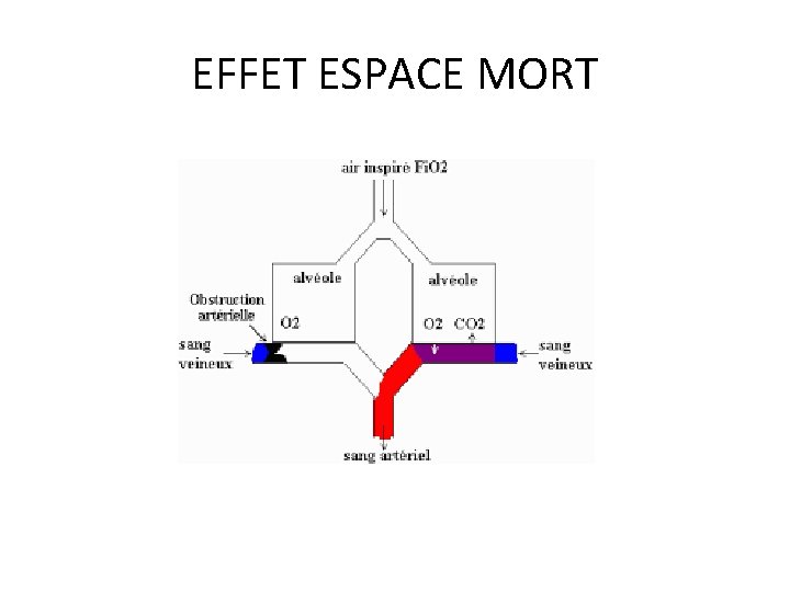 EFFET ESPACE MORT 