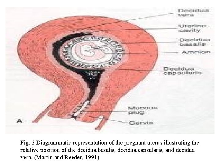 Fig. 3 Diagrammatic representation of the pregnant uterus illustrating the relative position of the