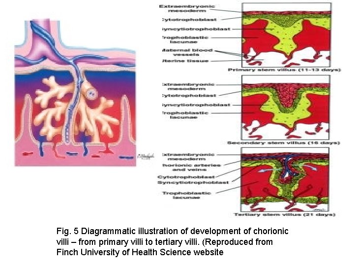 Fig. 5 Diagrammatic illustration of development of chorionic villi – from primary villi to