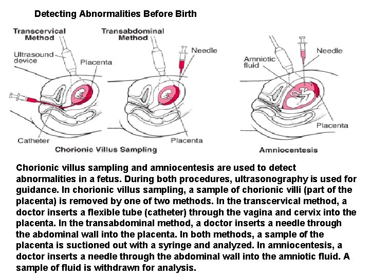 Detecting Abnormalities Before Birth Chorionic villus sampling and amniocentesis are used to detect abnormalities