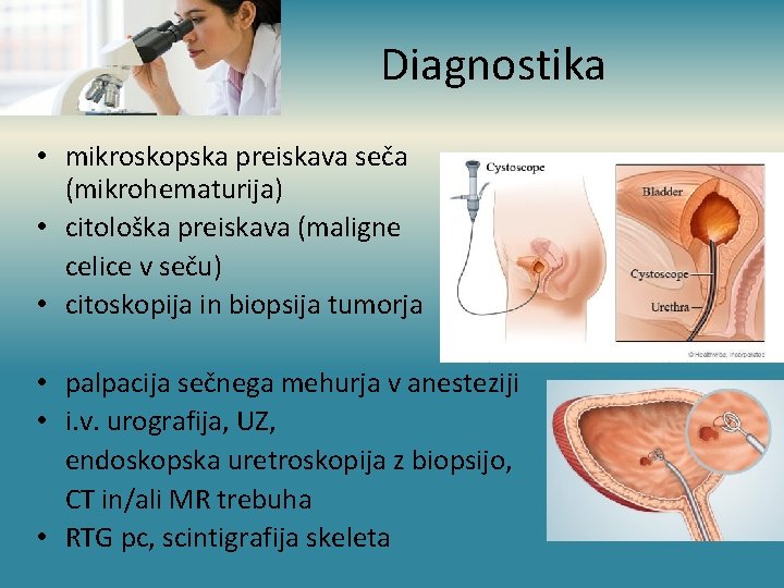 Diagnostika • mikroskopska preiskava seča (mikrohematurija) • citološka preiskava (maligne celice v seču) •