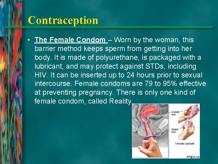 Contraception • The Female Condom – Worn by the woman, this barrier method keeps