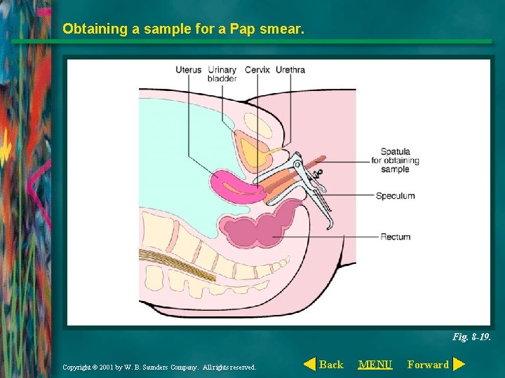 Obtaining a sample for a Pap smear. Fig. 8 -19. Copyright © 2001 by