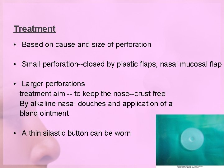 Treatment • Based on cause and size of perforation • Small perforation--closed by plastic