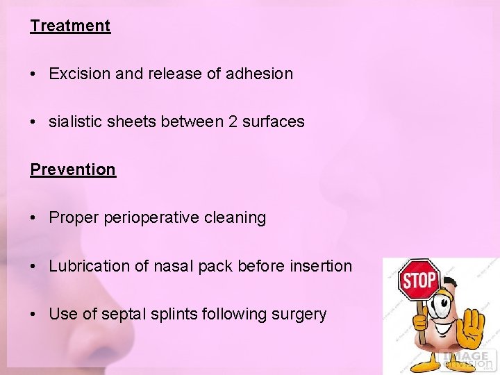 Treatment • Excision and release of adhesion • sialistic sheets between 2 surfaces Prevention