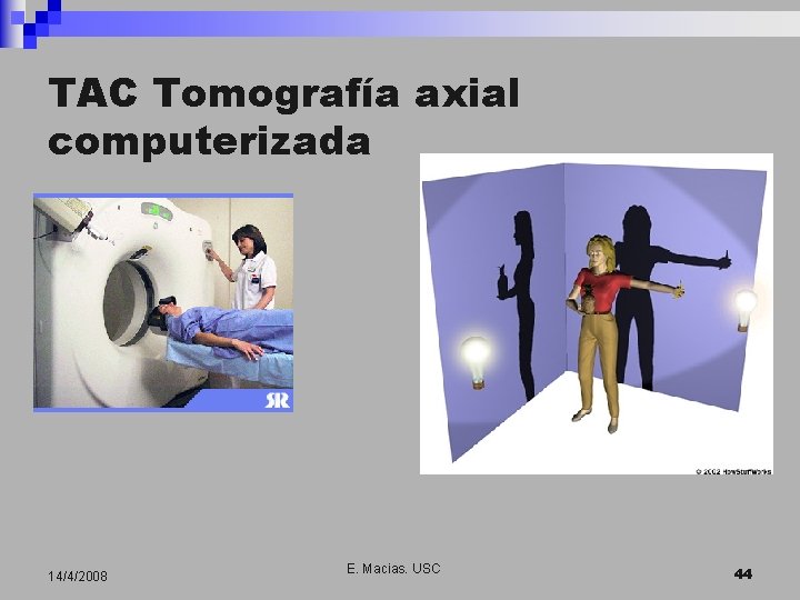 TAC Tomografía axial computerizada 14/4/2008 E. Macias. USC 44 