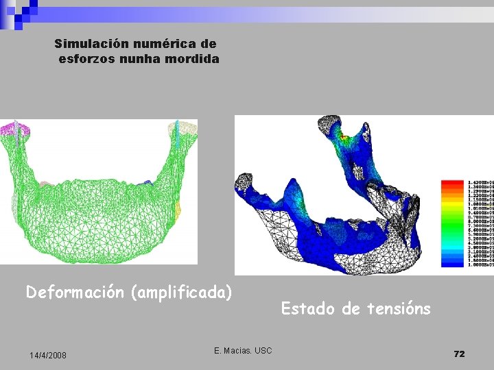 Simulación numérica de esforzos nunha mordida Deformación (amplificada) 14/4/2008 E. Macias. USC Estado de