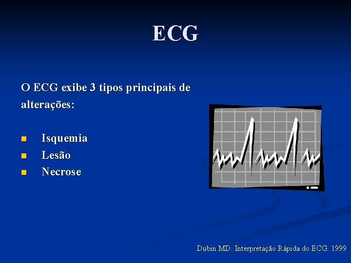 ECG O ECG exibe 3 tipos principais de alterações: n n n Isquemia Lesão