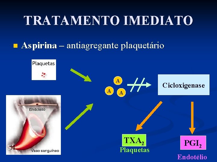 TRATAMENTO IMEDIATO n Aspirina – antiagregante plaquetário A A Cicloxigenase A TXA 2 Plaquetas