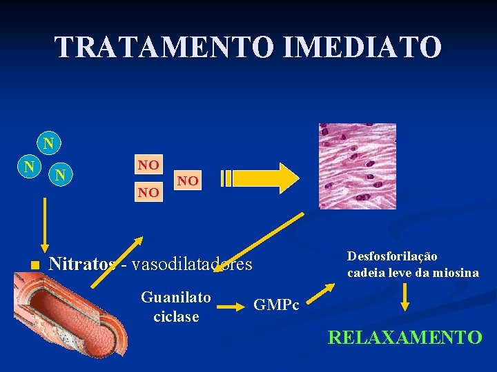 TRATAMENTO IMEDIATO N NO NO n NO Desfosforilação cadeia leve da miosina Nitratos -