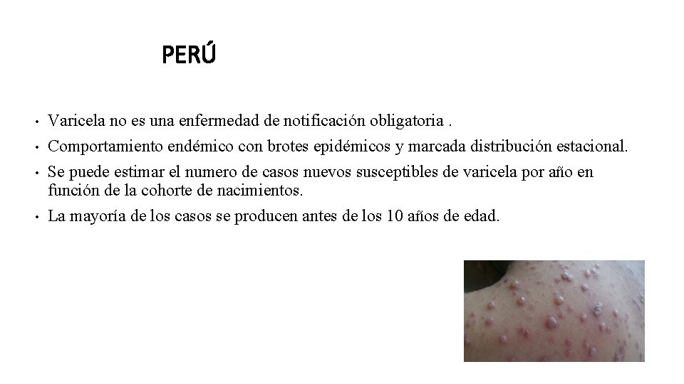 PERÚ • • Varicela no es una enfermedad de notificación obligatoria. Comportamiento endémico con